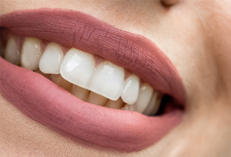 スターホワイトニングで美しい自然な白い歯を！